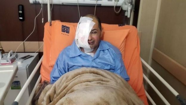 تخلیه چشم علیرضا رجایی روزنامه نگار به علت ممانعت مقامات زندان از ارائه خدمات پزشکی برای سرطان در زندان