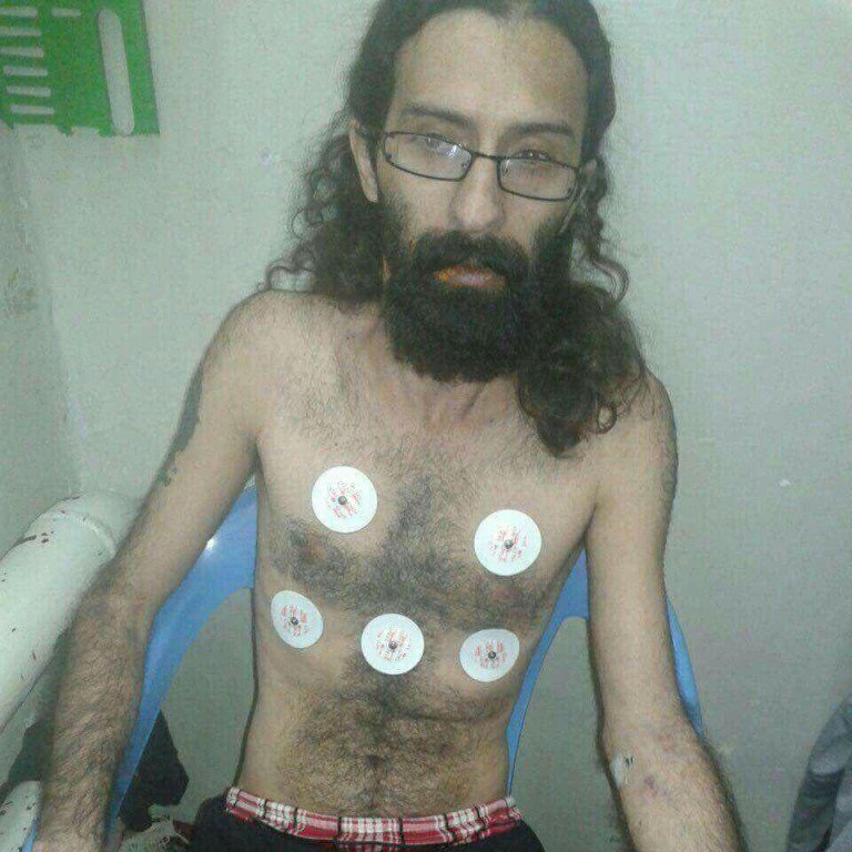 سعید شیرزاد پس از بیش از ۳۵ روز اعتصاب غذا در بیمارستان